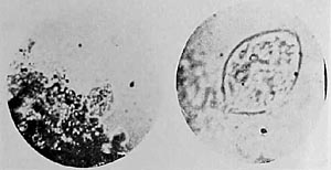 membrane-enclosed configuration